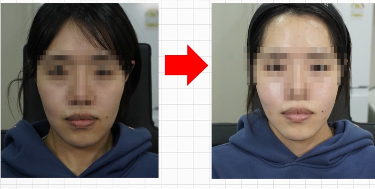 세르프 힐로웨이브