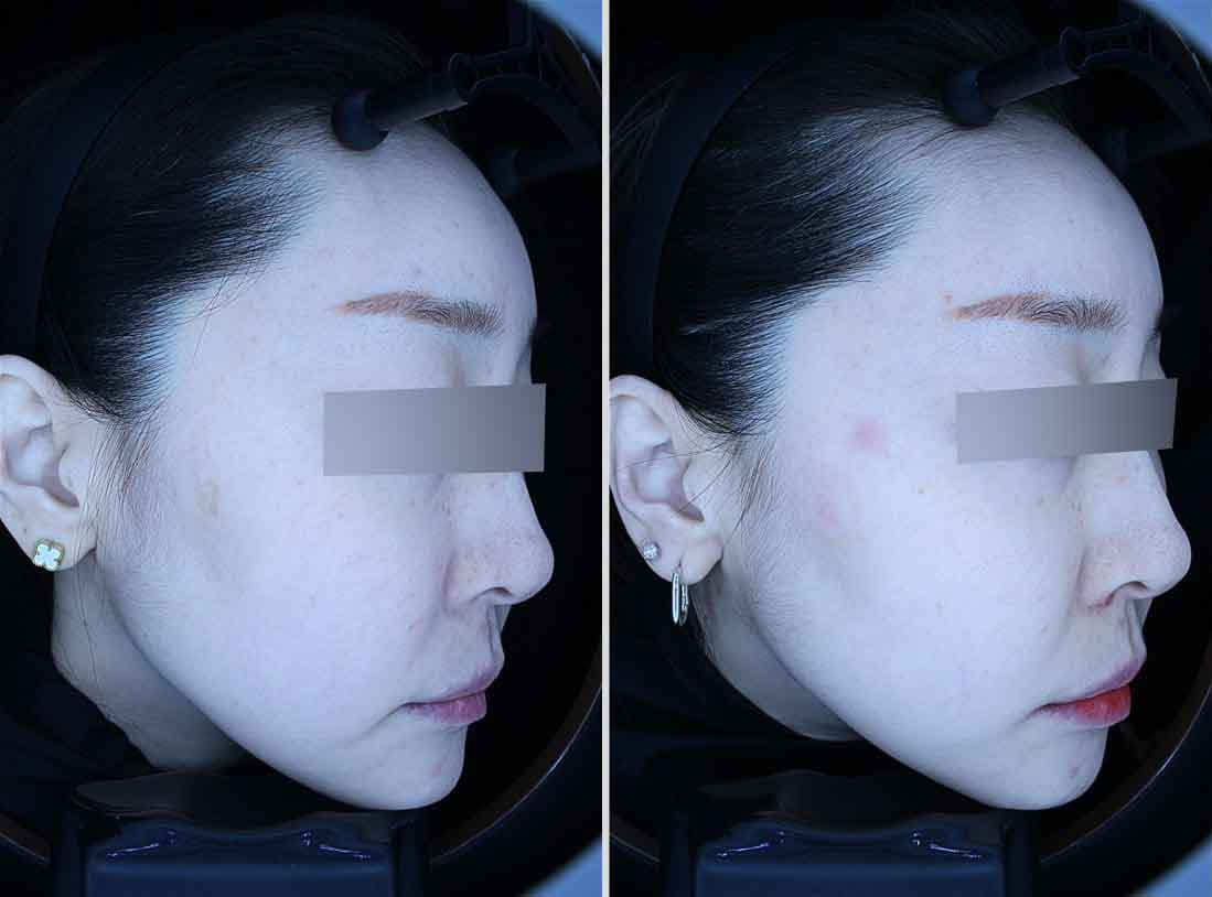 여성 흑자 진료 전후 비교
