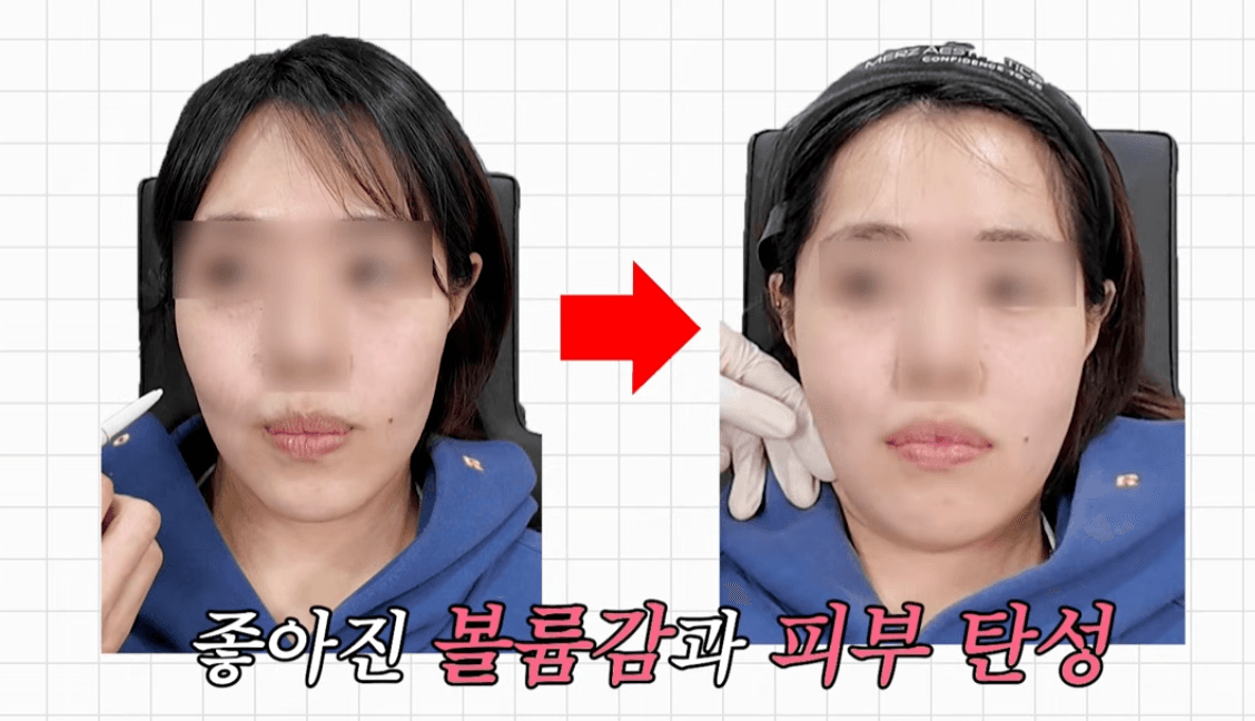 여의도 힐로웨이브