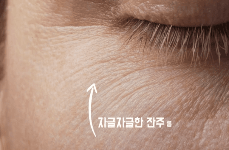 피부엄마 스킨보톡스